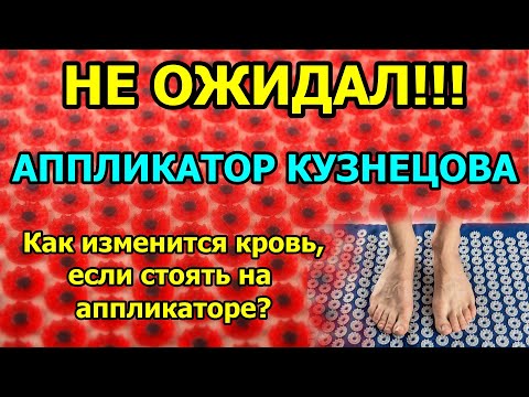 Кровь после аппликатора Кузнецова. Не ожидал