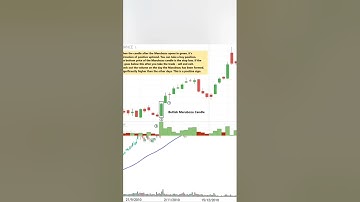 Candlestick Patterns - Marubozo Pattern | episode 6  #candlestickpattern #marubozu