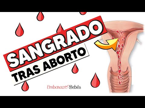 😥🩸 Cuánto dura el SANGRADO después de un ABORTO ESPONTÁNEO ¿Es normal?