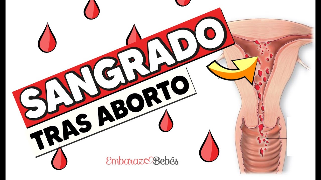 😥🩸 Cuánto dura el SANGRADO después de un ABORTO ESPONTÁNEO ¿Es normal ...
