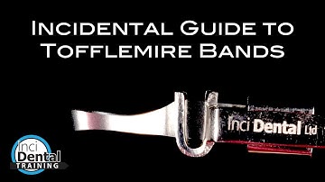 Guide to Tofflemire Bands and Retainers