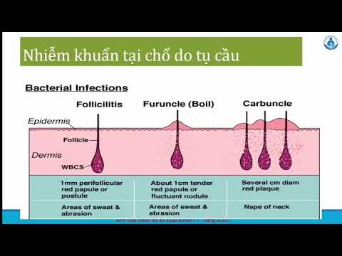 Video NHIỄM TRÙNG HUYẾT DO TỤ CẦU - youtube