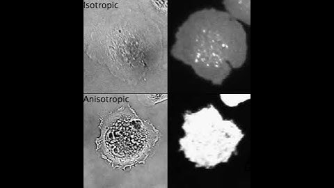 Isotropic and anisotropic spreading of fibroblasts
