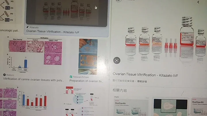 ›卵巢組織冷凍保存方法   玻璃化冷凍優於慢速冷凍 - 天天要聞
