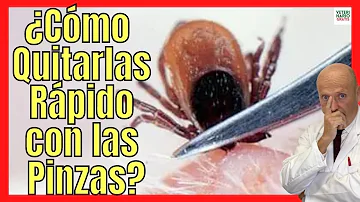 ¿Cómo se quita una garrapata si no se tienen pinzas?