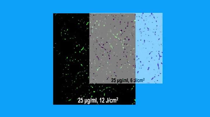 24C748361A78D1CF63F2D7729BDD7D#1