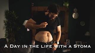 A day in the life of living with a Stoma | Changing my bag | Living a "normal" life