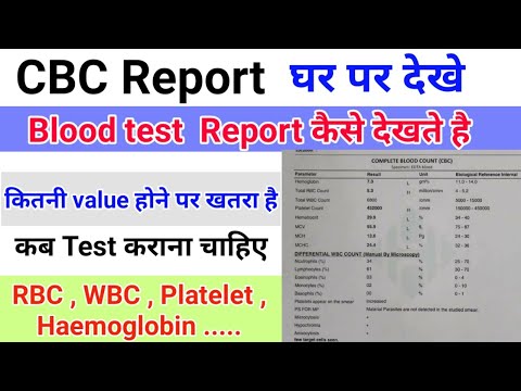 वीडियो: तीन कमरों वाले ख्रुश्चेव घरों का लेआउट: विकल्प, आकार, पुनर्विकास