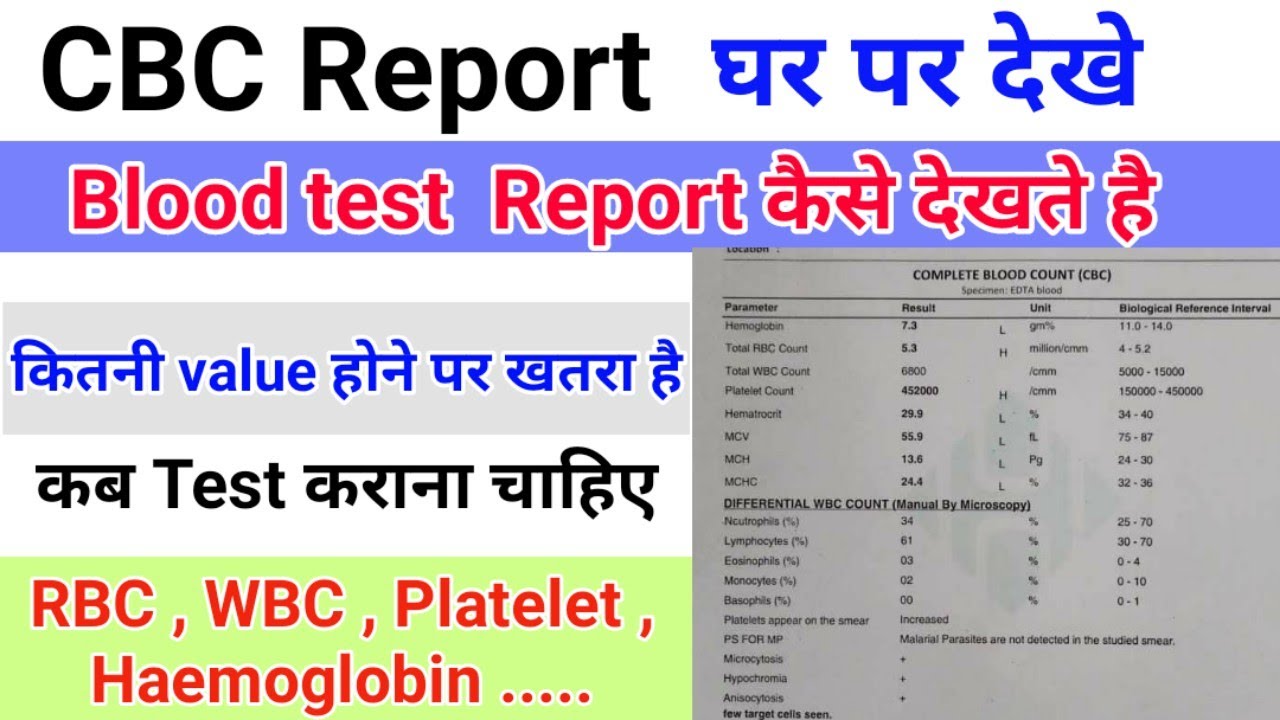 Blood report देखना सीखे CBC Report RBC , WBC , Platelets