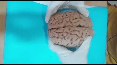 Sulci and gyri on superolateral surface of cerebral hemisphere