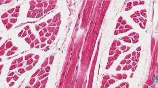 Corte histológico de Músculo estriado visceral - YouTube