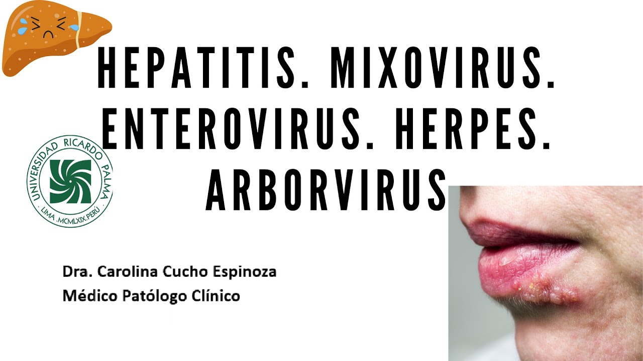 Microbiología - Hepatitis. Mixovirus. Enterovirus. Herpes. Arborvirus ...