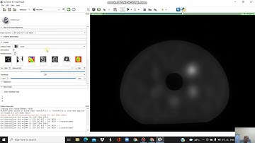 Image Registration Using 3D Slicer