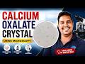 calcium oxalate crystals