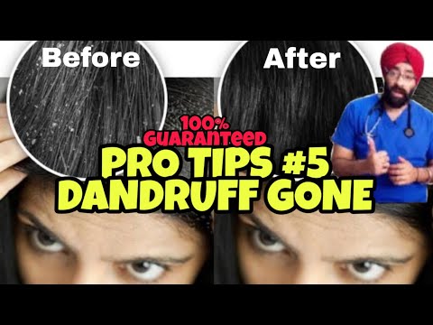 pro-tips-#5:-the-final-dandruff-solution!-isse-hi-jayega-|-dr.education-(hindi)