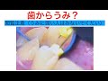 【歯の中からうみ！！】歯肉が腫れたら歯科へGO　歯根のう胞