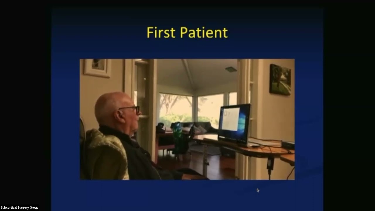 Fully Implanted Endovascular Brain Computer Interface