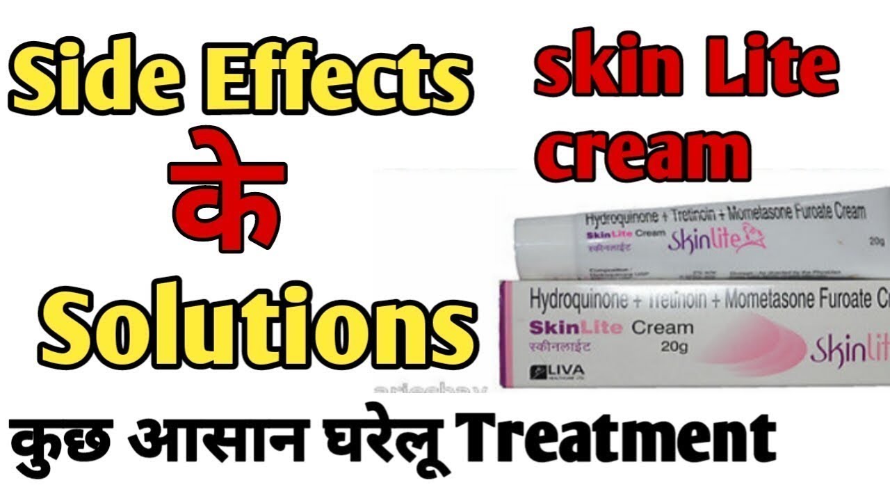 SkinLite cream side effects solution & treatment in hindi
