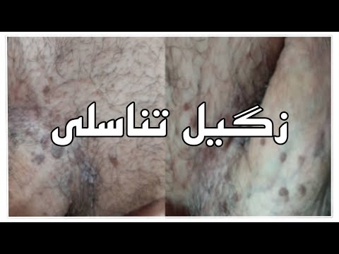 تصویری: چند بیماری مقاربتی وجود دارد؟