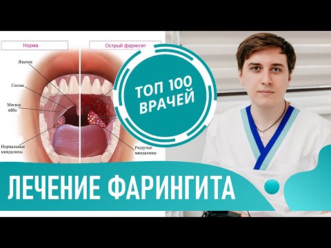 Как быстро вылечить фарингит в домашних условиях у ребенка