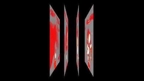 AtomicusChart®: Volume Sections Technique