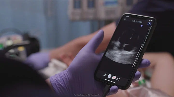 Butterfly iQ+: Bedside Cardiac Imaging