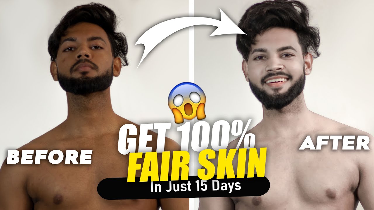 How to Get Fully Fair Skin In Just 15 Days😱
