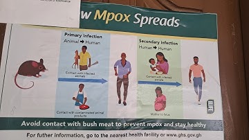 How Monkeypox Spread And How To Stay Safe 🦠🐒😷