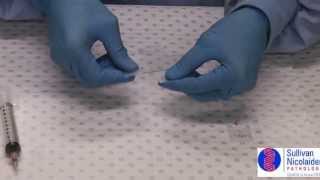 FNA slide preparation 1:using a spreader slide
