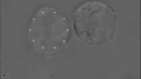 HEK Adhesion conducted using Elliot Scientific Optical Tweezers