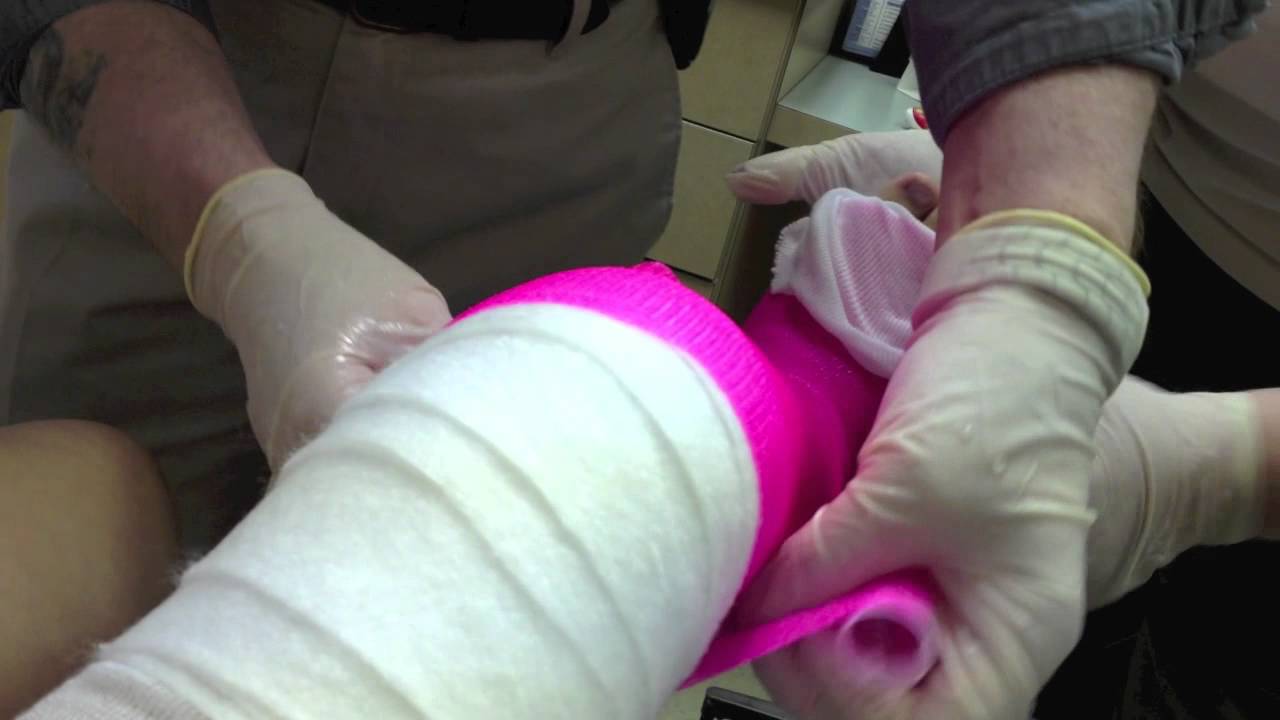 Ayla : getting pink cast on my leg!! 