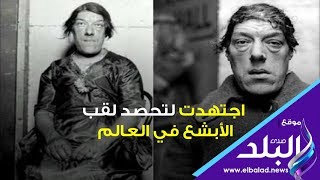 صدي البلد | قصة أبشع إمرأة في العالم .. هكذا ستتعاطف معها