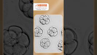 Can PGT-A Reduce the Risk of Recurrent Miscarriage? | IVF Embryo Chromosome Testing | Pregnancy Loss