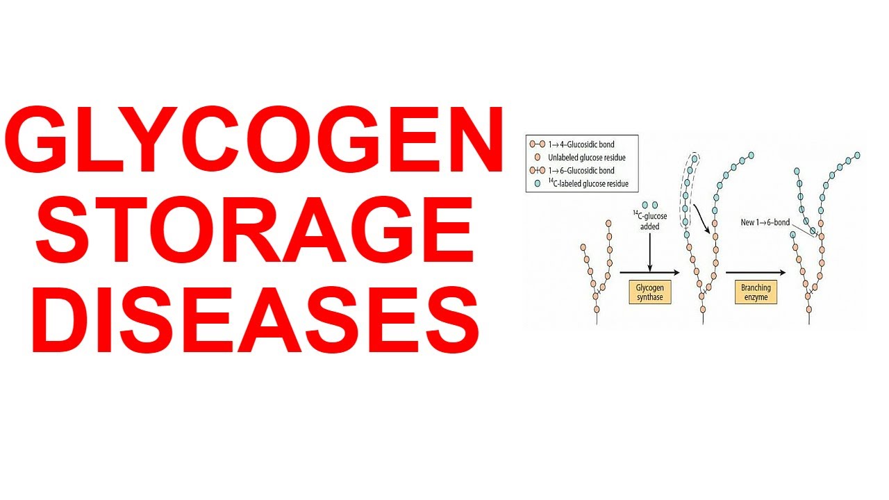 Glycogen Storage Diseases YouTube