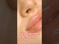 face surgery side effects #bollywood #ytshorts #shorts #shortsfeed #viral #viralvideo