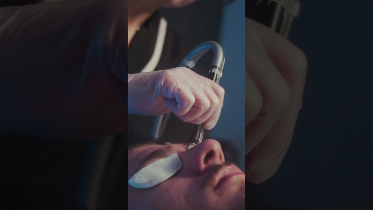 5 Expert Facts You Didn’t Know About Men’s Anti-Acne Facial – Estemica Laval