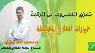 علاج تمزق غضروف الركبة