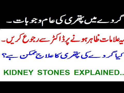 Kidney Stones Explained.