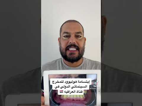 إبتسامة هوليوود بالفينير الثابت     فينير