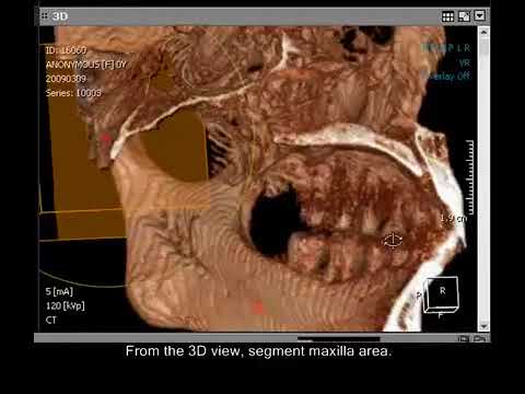 3D Segmentation Method A - YouTube