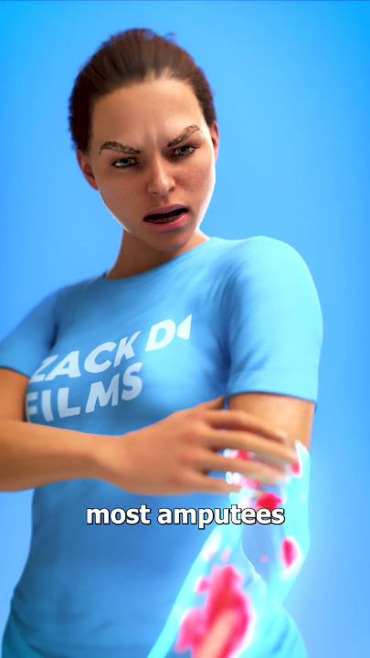 What Is Phantom Limb Pain? 😨