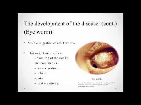 Vídeo: Comparação Das Respostas Imunes Aos Extratos De Antígenos Específicos De Estágio De Loa Loa Em Camundongos BALB / C Expostos A Loa Loa Após A Eliminação Da Infecção