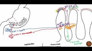 Peptic Ulcer for USMLE Step 1 and USMLE Step 2