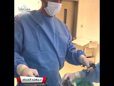 عملية تكميم المعدة مع د مهند الحداد من عيادة وي كير
