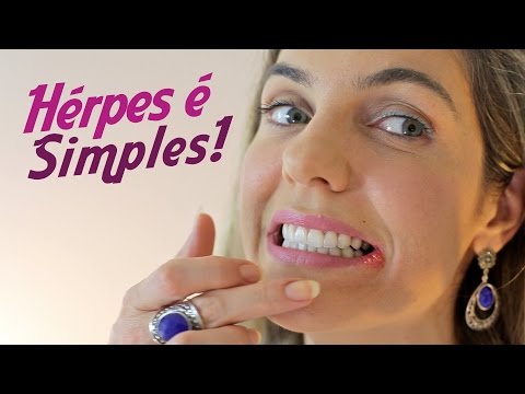 Dicas de como cuidar de Herpes