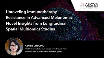 Immunotherapy Resistance in Advanced Melanoma: Insights from Longitudinal Spatial Multiomics Studies