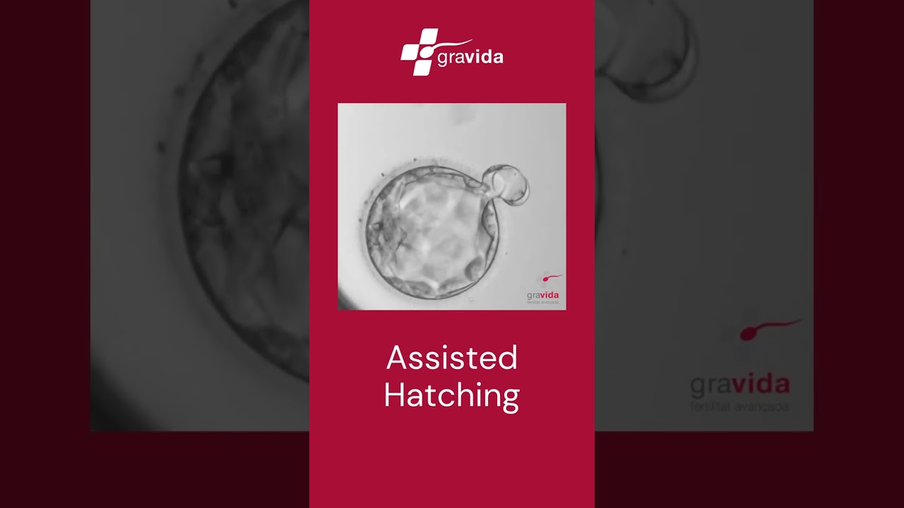 Målestok Afdæk Rekvisitter Qué es el ASSISTED HATCHING? - YouTube