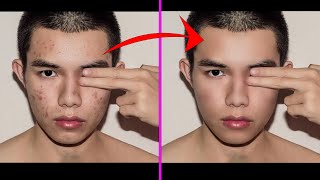 Efficient Facial Cleanup: Photoshop Techniques for Quick Pimple, Blemish, and Acne Removal