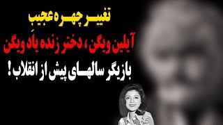 تغییر چهره تکان دهنده آیلین ویگن!