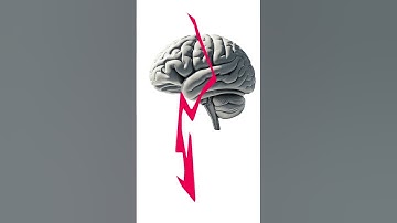 "Your Brain Deletes Memories On Purpose 😳"#Shorts #DidYouKnow #Facts #Learn #Subscribe